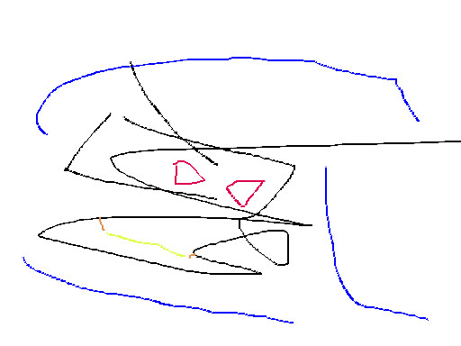 fradros Bild